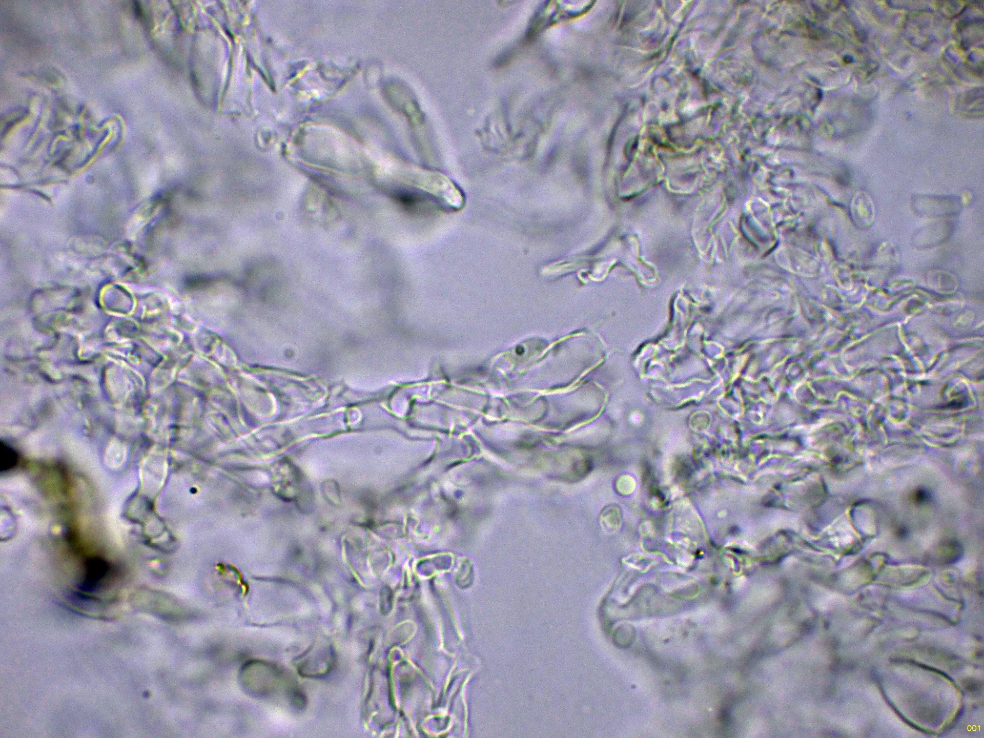 Microscopía de Sertulicium granuliferum - 10 - Hifas subhimeniales Melzer-001